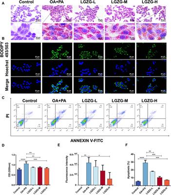 Lingguizhugan oral solution alleviates MASLD by regulating bile acids metabolism and the gut microbiota through activating FXR/TGR5 signaling pathways